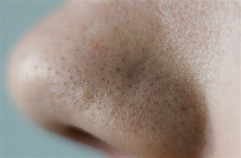 Clogged Pores After Makeup - Mugeek Vidalondon