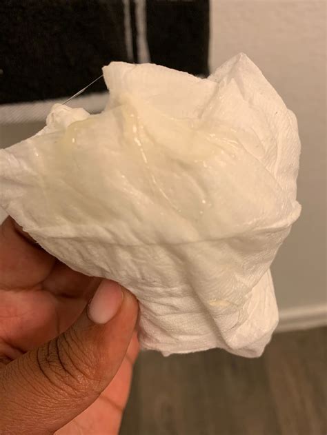 Clear Mucus Plug Discharge