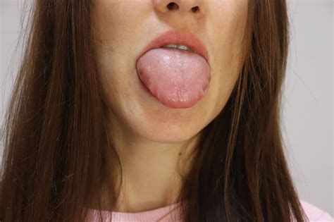 Causes of a Scalloped Tongue | John Douillard's LifeSpa