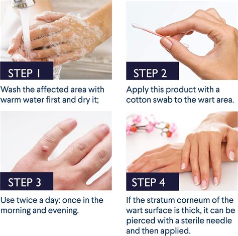 Maximum Strength Fast-Acting Liquid Wart Gel with Salicylic Acid - For Various Types of Warts ...