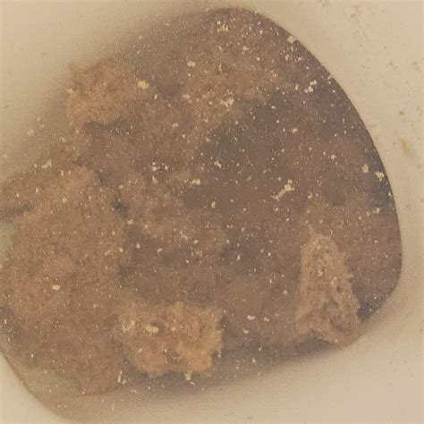 Having strange particles in stool and having other symptoms consistent ...