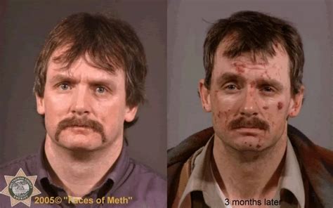 The faces of meth reversed - Mirror Online