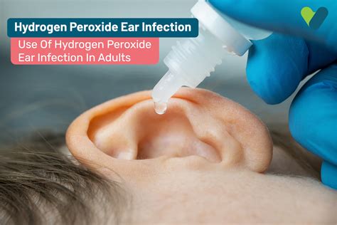 Hydrogen Peroxide Ear Infection: Use of Hydrogen Peroxide For Ear ...
