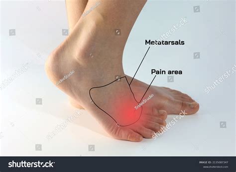 Metatarsal Pain