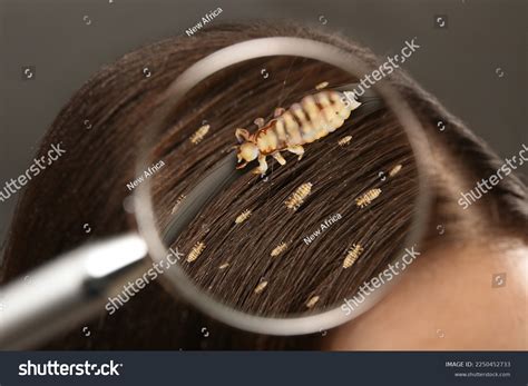 Pediculosis Woman Lice Nits Closeup View Stock Photo 2250452733 ...