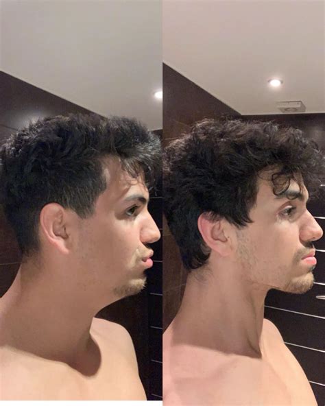 What Is Tongue Chewing Exercise (MEWING) and How To Do it For A Stronger Jawline