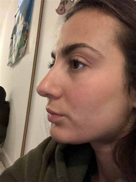 Ex told me nose is big and it is all I can think about. I am have Greek so it isn’t tiny, but is ...