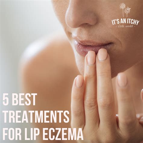 The Best Natural Treatments for Lip Eczema | itchylittleworld.com