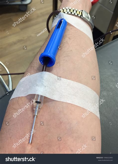Plasma Donation Needle