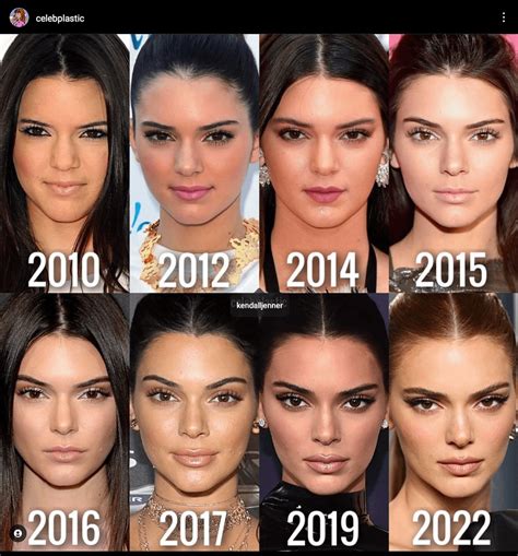Rate Kendall Jenner before and after plastic surgery : r/VindictaRateCelebs