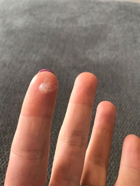 thick clear jelly like discharge - Captions Domestic