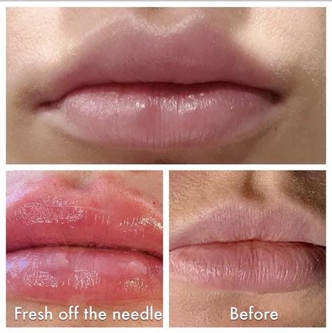 Gallery & Testimonials - Beyond Bella Aesthetics