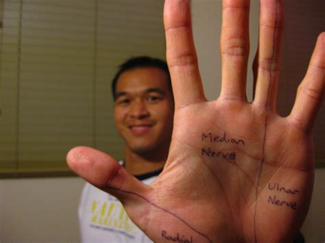 Hand Of Benediction Vs Ulnar Claw