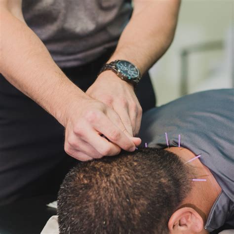 Dry Needling Technique In Physical Therapy at Dan Samples blog