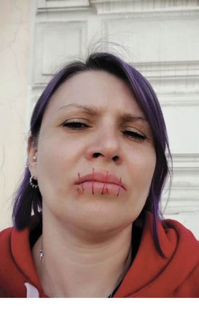 With Mouths Sewn Shut - Russian Life