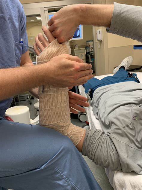 How to Splint a Wrist Fracture - Ortho Conditioning