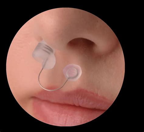 Back2Sleep Anti-Snoring Nasal Stent - Breathewell Medical