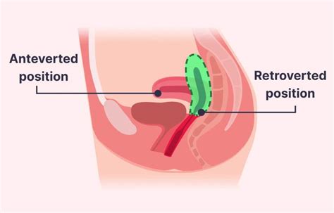 Mucus plug vs. discharge: Understanding the differences - Femia Health