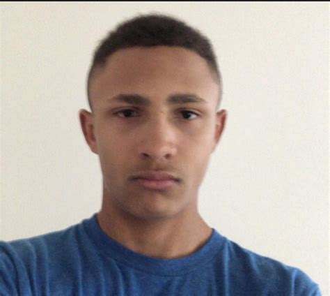 15 and recessed/ugly w/ upper eyelid exposure ——> 18 and still ugly but ...