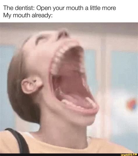 The dentist: Open your mouth a little more My mouth already: - iFunny