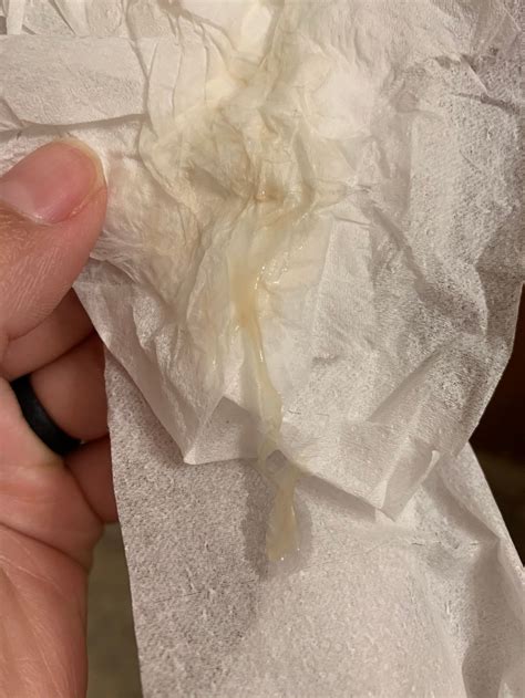 9 Weeks Pregnant Yellow Discharge