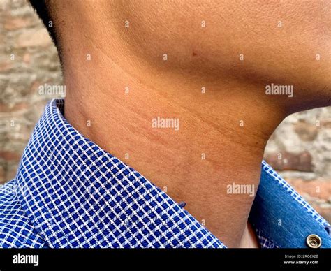 Aging skin folds or skin creases or wrinkles at neck of Southeast Asian, Chinese young man Stock ...
