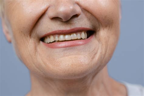 Implant Retained Denture | JJ Denture Design