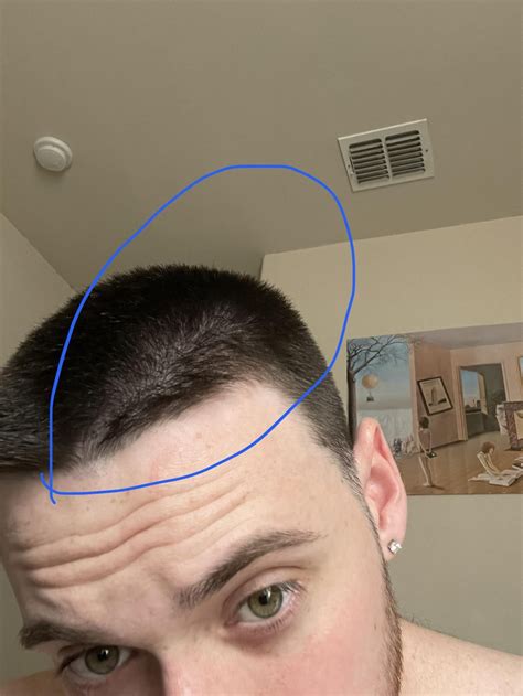 [ADVICE] Is this line a part or a cowlick? Buzzed my hair last week and ...
