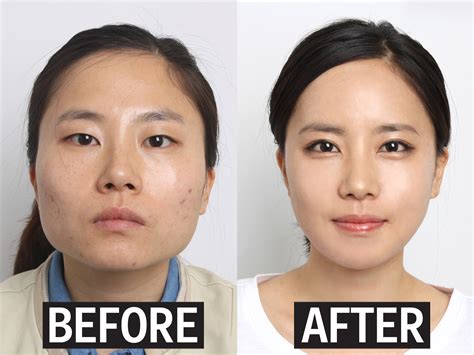 Real Korean Face Without Surgery