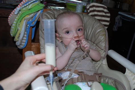 Tube Feeding In Infants