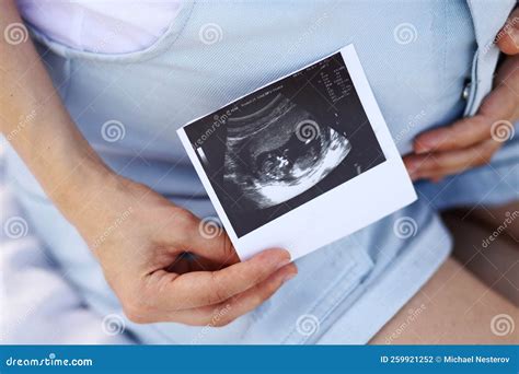 Pregnant Woman Holding Ultrasound Image, X-ray Stock Photo - Image of ...