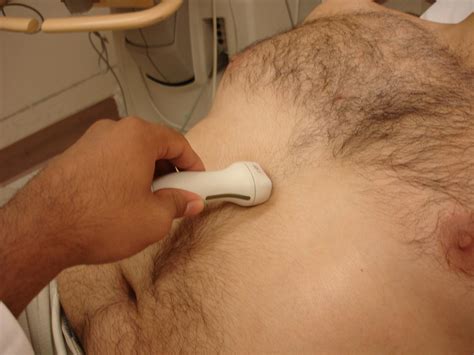 Abdominal ultrasound - eFAST - method, indications and interpretation ...