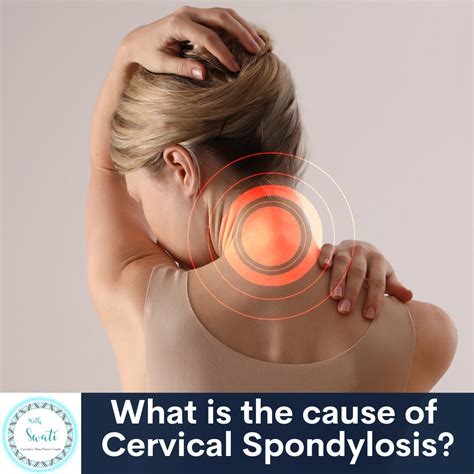What is the cause of Cervical Spondylosis (Neck Arthritis)? | Swati Prakash