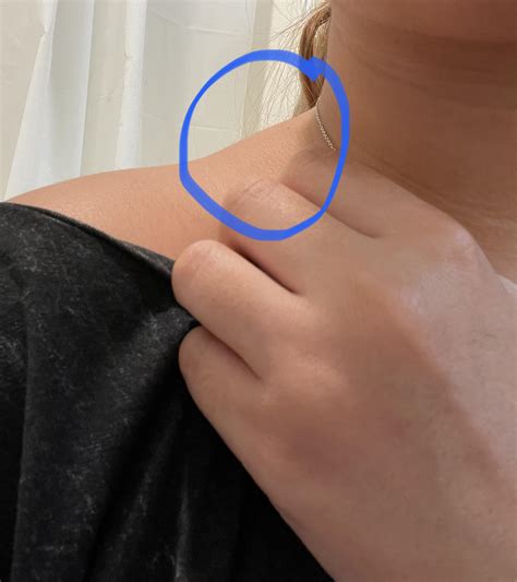 Swollen Lymph Nodes In Shoulder