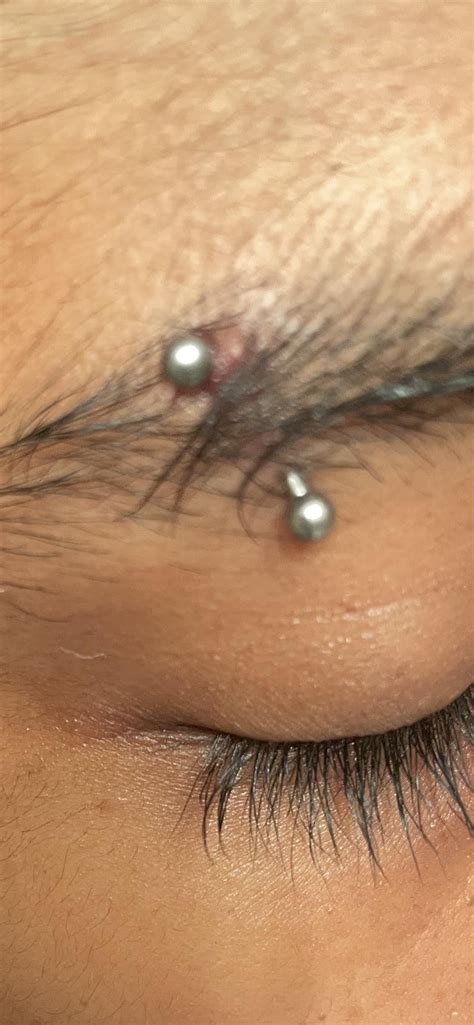 eyebrow piercing - infected or irritated? : r/PiercingAdvice