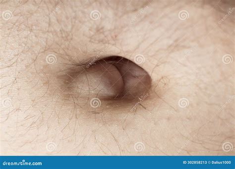Lump in Belly Button - Hernia, an Inflammatory Condition - Possible Cancer Stock Image - Image ...