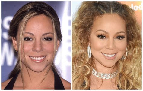 Mariah Carey Face Surgery