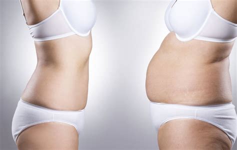 PCOS Belly Shape - What Does It Look Like and Why Does It Happen?