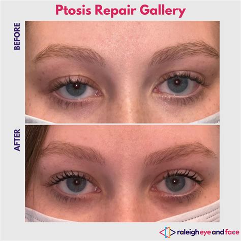 Gallery Menu — Raleigh Eye and Face