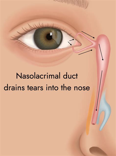 Swollen Eyelid Blocked Tear Duct Treatment at Neomi Ingram blog