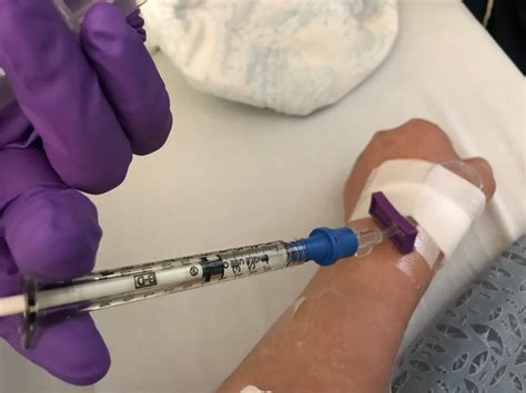 Intravenous Definition Medical at Dorothy Lessard blog