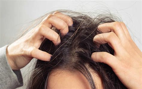 Top Oils for Dry Scalp: Hydrate, Soothe, & Restore Your Scalp Health
