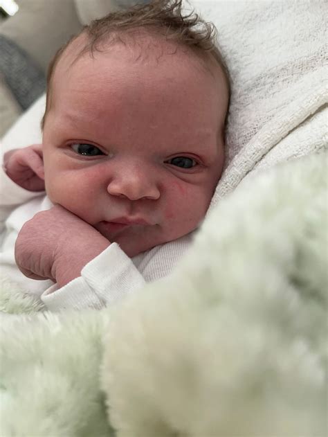 Baby’s eyes far apart | BabyCenter