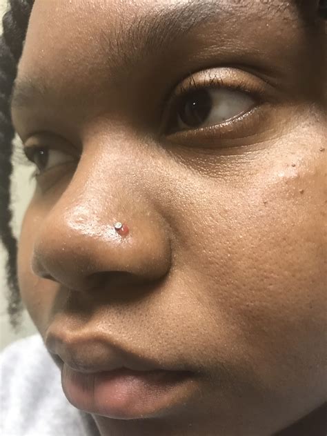 Weird Bump On Nose Piercing. I'm not sure with this is but it keeps ...