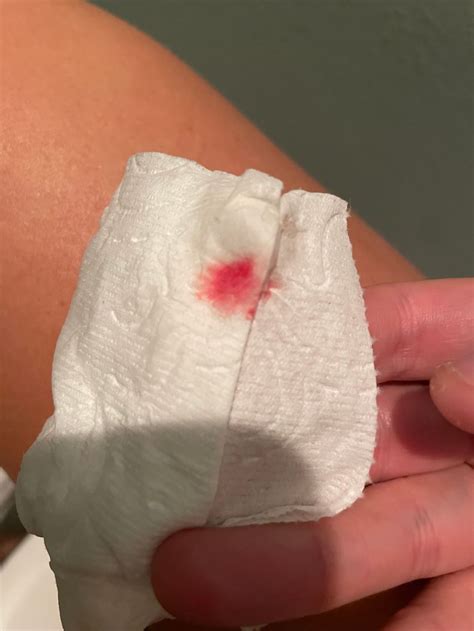 Cervical Mucous Early Pregnancy Stages