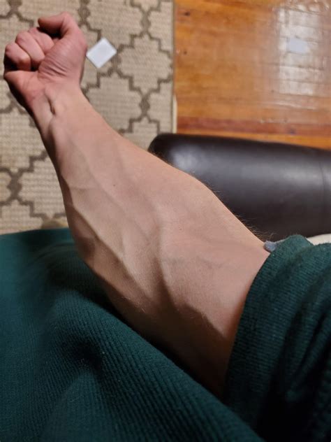 Veins Popping Out