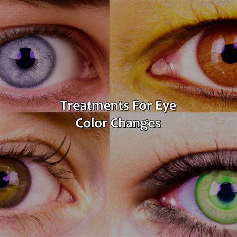 What Causes Eye Color To Change In Adults - colorscombo.com