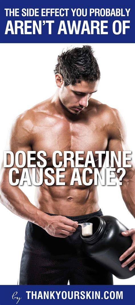 Creatine Does It Cause Acne