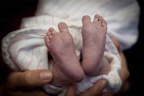 Acrocyanosis In Infants