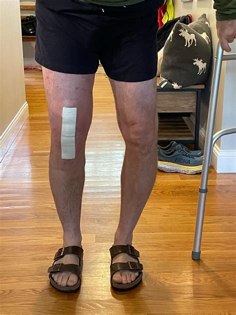The First of Two Knee Replacements Yielded me 2.5 Inches in Height due ...